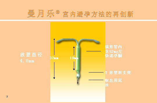 温州上曼月乐环多少钱